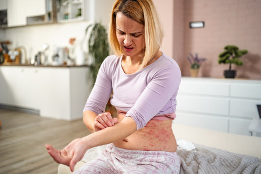 What Is Eczema – Atopic Dermatitis Causes, Triggers And Symptoms